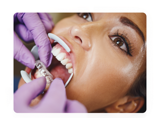 Dentist fitting clear aligners